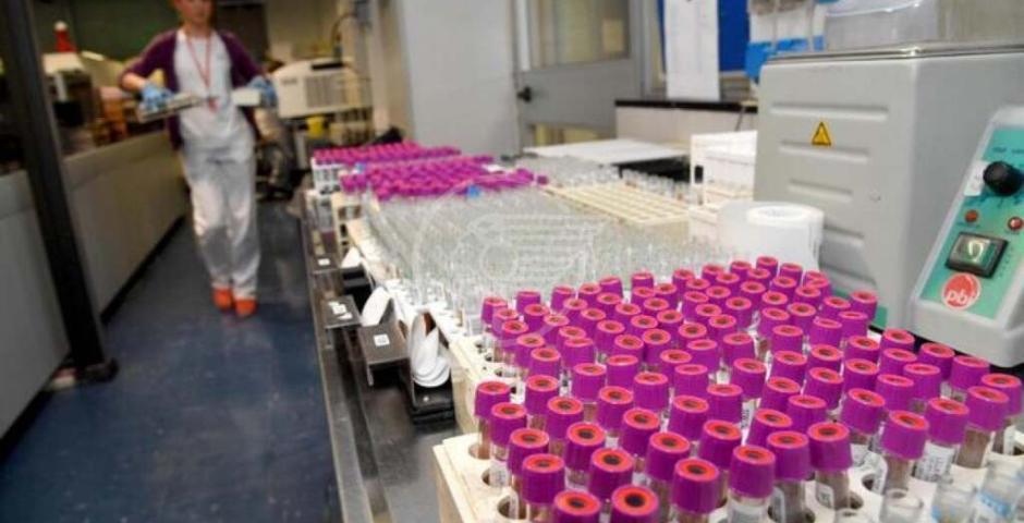 Il vaccino per la tubercolosi è più efficace se somministrato per via endovenosa Il vaccino per la tubercolosi è più efficace se somministrato per via endovenosa